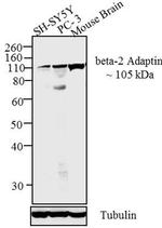 beta-2 Adaptin Antibody in Western Blot (WB)