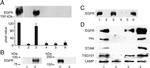 EGFR Antibody in Western Blot (WB)