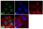 Androgen Receptor Antibody in Immunocytochemistry (ICC/IF)