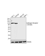 Androgen Receptor Antibody in Western Blot (WB)