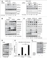 HIF-2 alpha Antibody in Western Blot (WB)