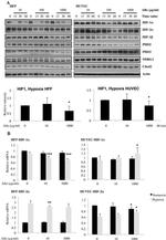 HIF-2 alpha Antibody in Western Blot (WB)