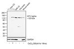 HIF-2 alpha Antibody in Western Blot (WB)