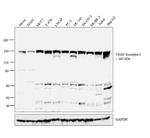 VEGF Receptor 2 Antibody in Western Blot (WB)