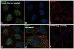 HIF1A Antibody in Immunocytochemistry (ICC/IF)