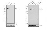 NEFM Antibody in Western Blot (WB)