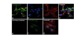 NEFM Antibody