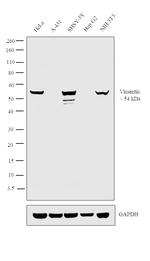 Vimentin Antibody