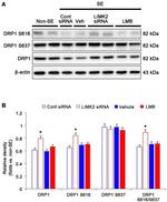 DNM1L Antibody in Western Blot (WB)