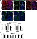 ADAMTS5 Antibody in Immunohistochemistry (Paraffin) (IHC (P))