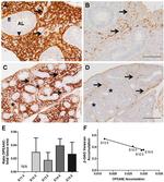 Versican V0, V1 Neo Antibody in Immunohistochemistry (IHC)