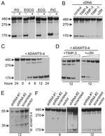 ADAMTS4 Antibody in Western Blot (WB)