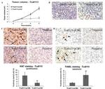 Ki-67 Antibody in Immunohistochemistry (IHC)