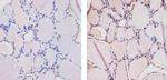 THRA Antibody in Immunohistochemistry (Paraffin) (IHC (P))