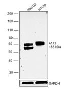 alpha-1 Antitrypsin Antibody in Western Blot (WB)