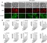 Collagen I Antibody in Immunocytochemistry (ICC/IF)