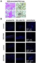 Thrombospondin 1 Antibody in Immunohistochemistry (IHC)