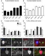 Estrogen Receptor alpha Antibody in Immunohistochemistry (IHC)