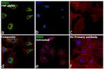 SOD2 Antibody