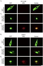 Estrogen Receptor beta Antibody in Immunohistochemistry (IHC)