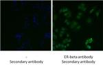 Estrogen Receptor beta Antibody in Immunocytochemistry (ICC/IF)