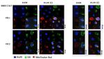 Estrogen Receptor beta Antibody in Immunocytochemistry (ICC/IF)