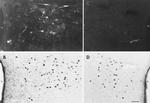 Estrogen Receptor beta Antibody in Immunocytochemistry (ICC/IF)