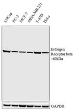 Estrogen Receptor beta Antibody in Western Blot (WB)