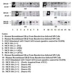 Estrogen Receptor beta Antibody in Western Blot (WB)