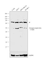 Estrogen Receptor beta Antibody in Western Blot (WB)