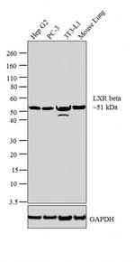 LXR beta Antibody in Western Blot (WB)