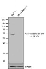 CYP2A6 Antibody in Western Blot (WB)