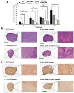 Ki-67 Antibody in Immunohistochemistry (IHC)