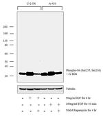 Phospho-S6 (Ser240, Ser244) Antibody in Western Blot (WB)