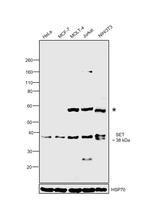 SET Antibody in Western Blot (WB)