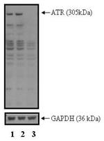 ATR Antibody in Western Blot (WB)