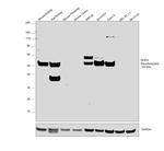 DOPA Decarboxylase Antibody in Western Blot (WB)