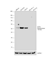 DOPA Decarboxylase Antibody in Western Blot (WB)