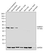 GABRA1 Antibody in Western Blot (WB)