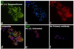 Tyrosine Hydroxylase Antibody in Immunocytochemistry (ICC/IF)