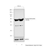 Tyrosine Hydroxylase Antibody in Western Blot (WB)