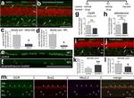 Glucocorticoid Receptor Antibody in Immunohistochemistry (IHC)