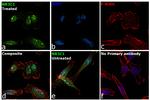 Glucocorticoid Receptor Antibody in Immunocytochemistry (ICC/IF)