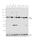 ATRIP Antibody in Western Blot (WB)