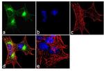 CaMKIV Antibody in Immunocytochemistry (ICC/IF)