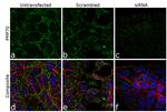 PMP70 Antibody in Immunocytochemistry (ICC/IF)