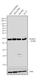 SNAP25 Antibody in Western Blot (WB)