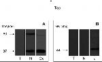 Cannabinoid Receptor 1 Antibody in Western Blot (WB)