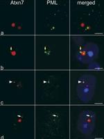 Ataxin 7 Antibody in Immunocytochemistry (ICC/IF)