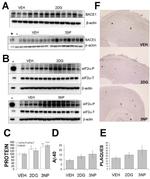 BACE1 Antibody in Western Blot (WB)